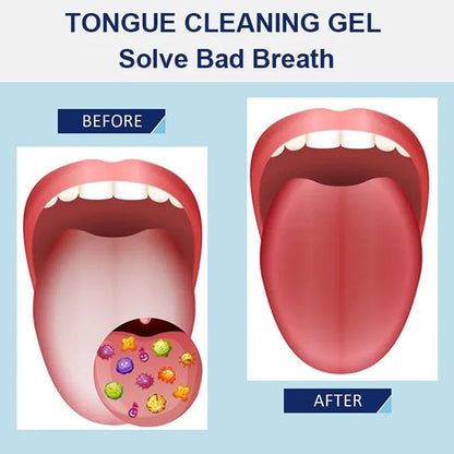 Fresh Breath Tongue Cleaning Gel Set